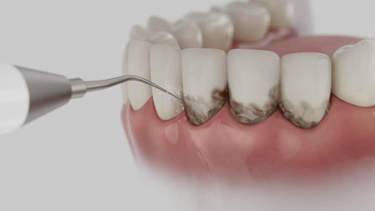 Trusted Root Canal Treatment service in Canton, PA - Dentist Open Now